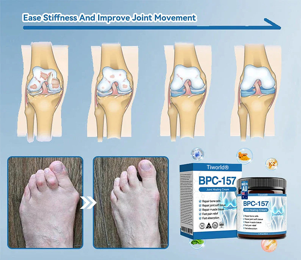 Tiworld® BPC-157 Joint Healing Cream🦴Treats Arthritis, Neuropathy, Rheumatism, Sports Injuries & More🏆