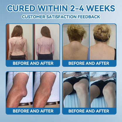 Tiworld® BPC-157 Joint Healing Cream🦴Treats Arthritis, Neuropathy, Rheumatism, Sports Injuries & More🏆