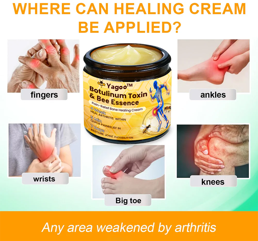 (🔥LAST DAY SALE - 80% OFF) 🐝Yagoo™ Botulinum & Bee Essence Pain Relief Bone Healing Cream