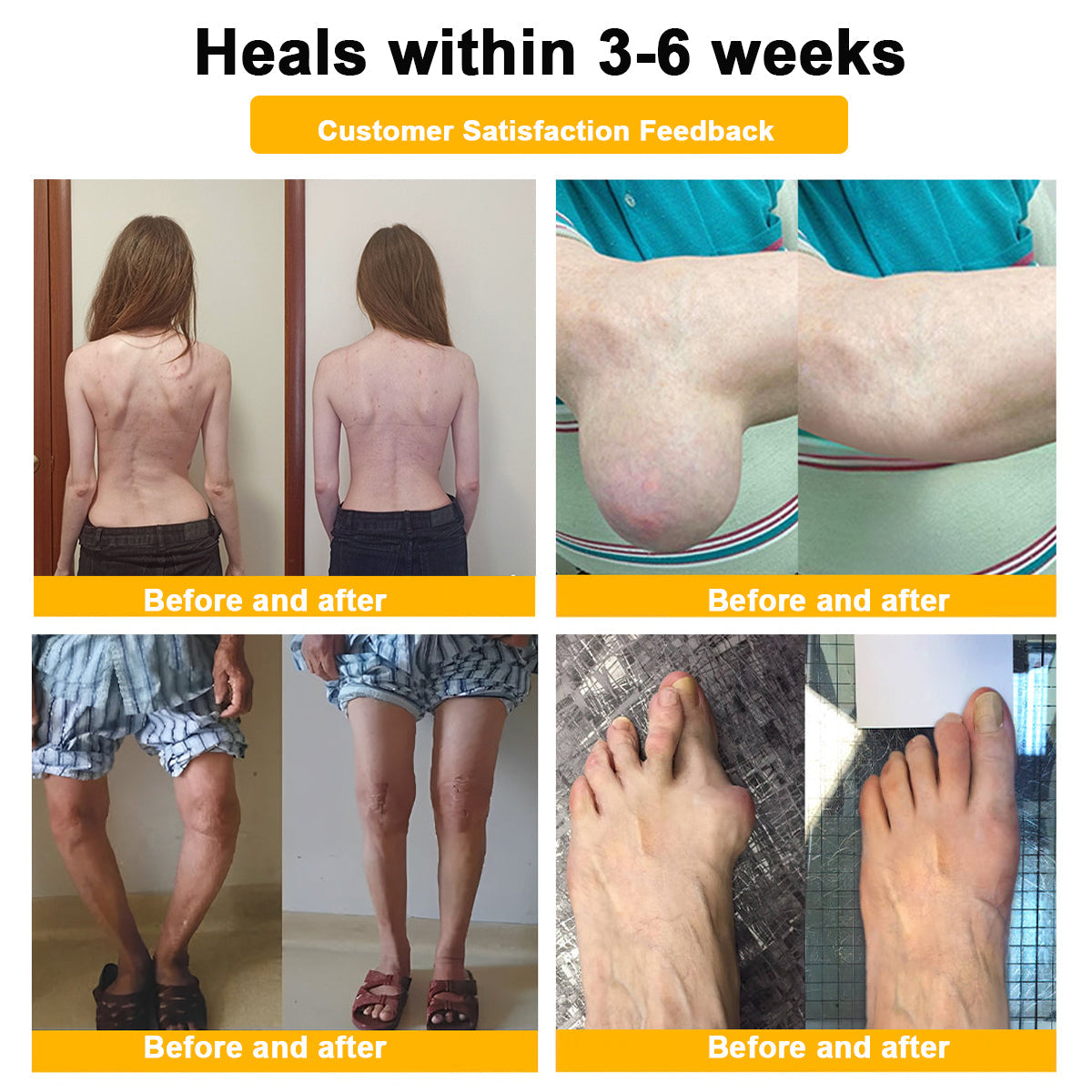 (🔥LAST DAY SALE - 80% OFF) 🐝Yagoo™ Botulinum & Bee Essence Pain Relief Bone Healing Cream