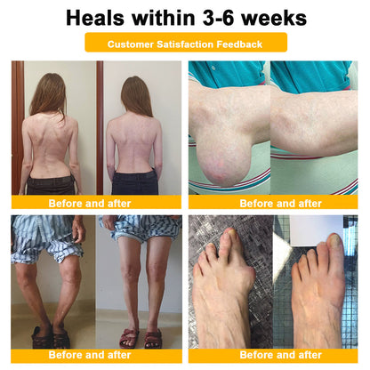 (🔥LAST DAY SALE - 80% OFF) 🐝Yagoo™ Botulinum & Bee Essence Pain Relief Bone Healing Cream