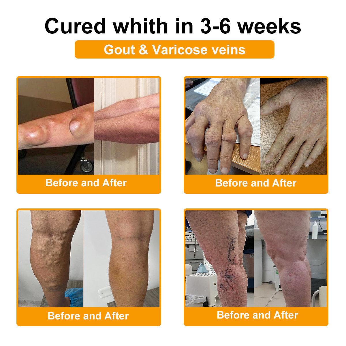 (🔥LAST DAY SALE - 80% OFF) 🐝Yagoo™ Botulinum & Bee Essence Pain Relief Bone Healing Cream