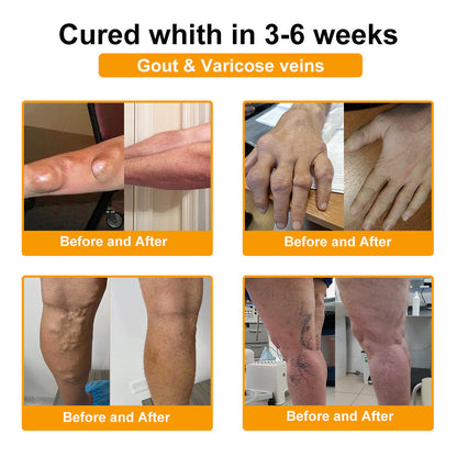 (🔥LAST DAY SALE - 80% OFF) 🐝Yagoo™ Botulinum & Bee Essence Pain Relief Bone Healing Cream