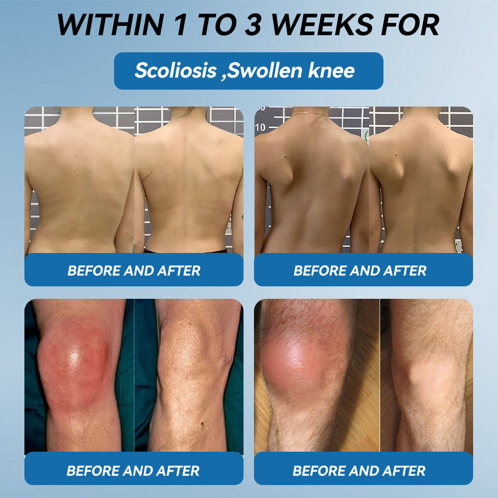 Tiworld® BPC-157 Joint Healing Cream🦴Treats Arthritis, Neuropathy, Rheumatism, Sports Injuries & More🏆