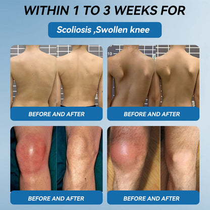 Tiworld® BPC-157 Joint Healing Cream🦴Treats Arthritis, Neuropathy, Rheumatism, Sports Injuries & More🏆