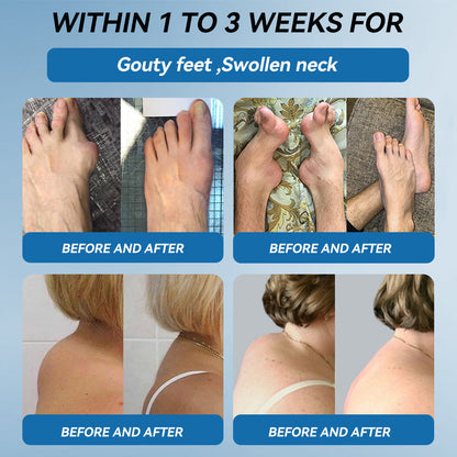 Tiworld® BPC-157 Joint Healing Cream🦴Treats Arthritis, Neuropathy, Rheumatism, Sports Injuries & More🏆