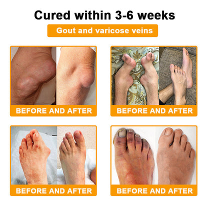 (🔥LAST DAY SALE - 80% OFF) 🐝Yagoo™ Botulinum & Bee Essence Pain Relief Bone Healing Cream