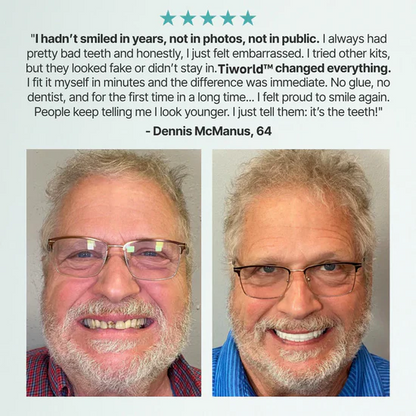 "Last Chance: 70% OFF Tiworld™ Custom-Fit Full Dentures – Boost Your Confidence Today!"